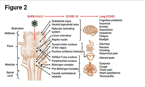 brainstem damage COVID