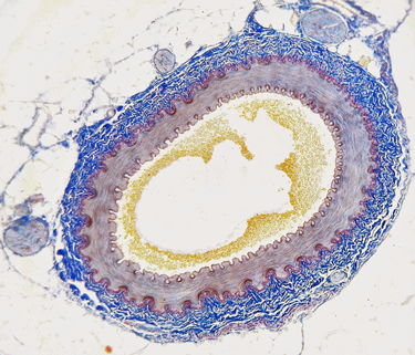 An artery (from Wikimedia)