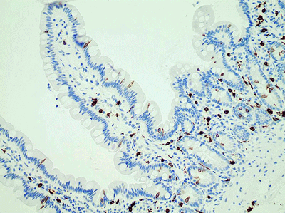 Mast cells gut