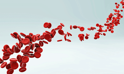 deformed red blood cells