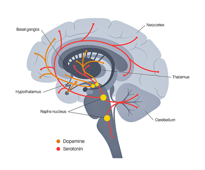 Solriamfetol - dopamine - ME/CFS