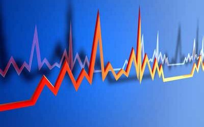 EKG