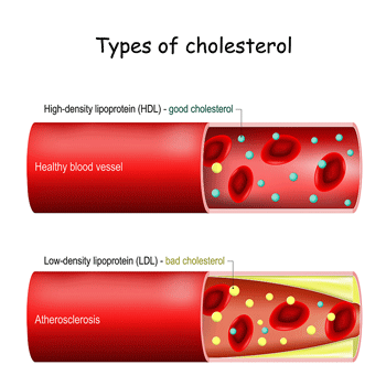 cholesterol