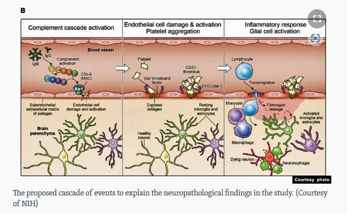 Nath endothelial cells long COVID