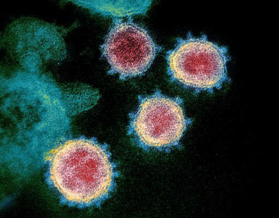 SARS-CoV-2 coronavirus