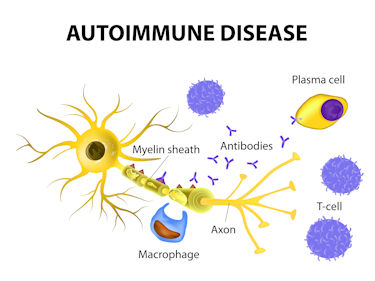 Autoimmunity Goebel