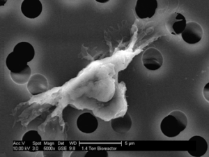 EBV-infected cells