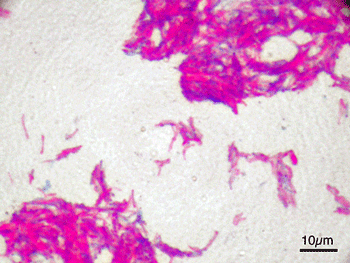 Mycobacterium bovis