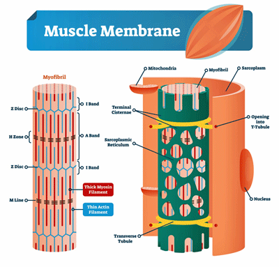 Evidence of muscle membrane damage has been accumulating in ME/CFS for decades. 