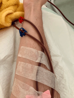 Lighter colored blood after apheresis
