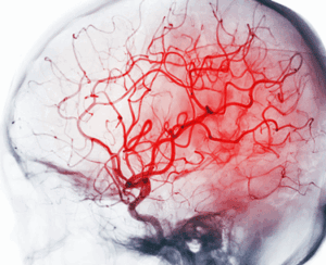 Blood vessels in brain