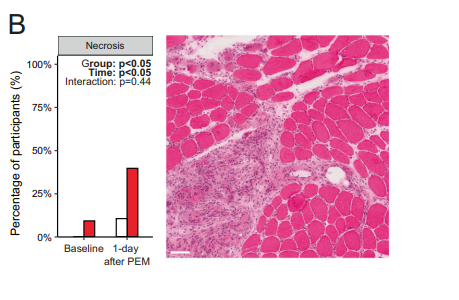 Dead muscle fibers