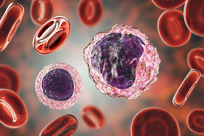 The Complement Connection in Long COVID: Microclots, Herpesviruses and More – Could it Explain Much?