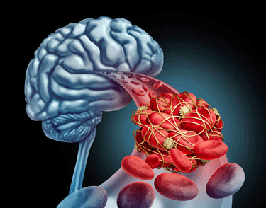 Blood flows to the brain