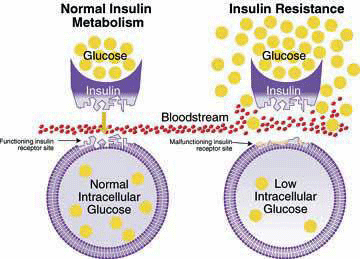 Insulin Resistance