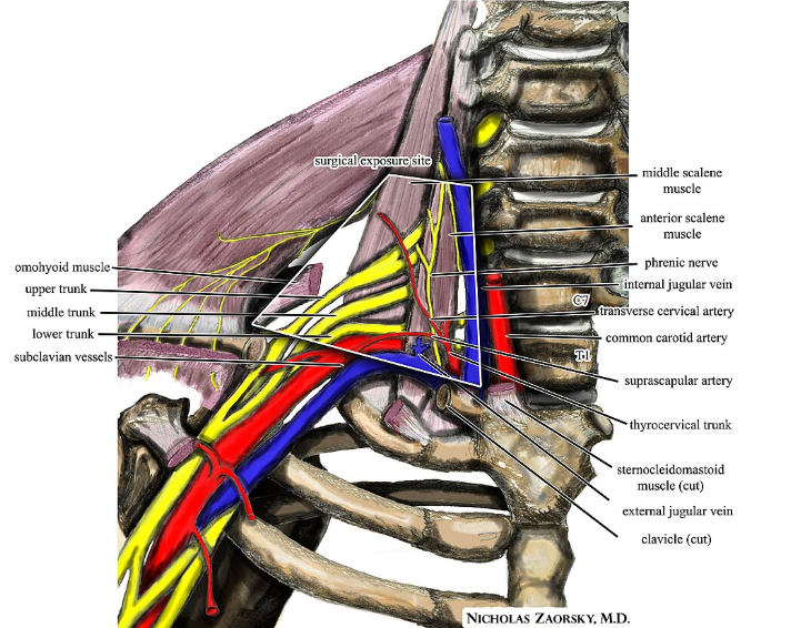 Thoracic outlet syndrome