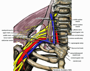 Thoracic Outlet Syndrome (TOS) Commonly Found in ME/CFS and Chronic Fatigue