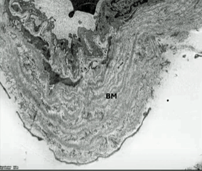 Basement membrane