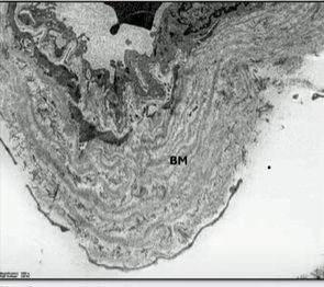 Basement membrane 