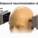 tFUS device (From study)