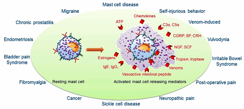 mast cell chronic pain syndromes