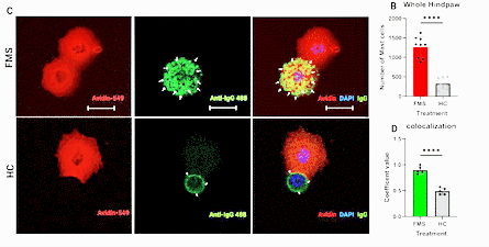 fibromyalgia IgG binding to mice mast cells