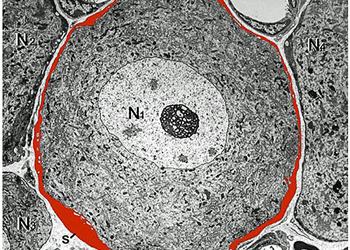 Satellite glial cell (red) surrounding sensory neuron