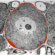 Turning the Pain up in Fibromyalgia: The Antibody Mast Cell Connection