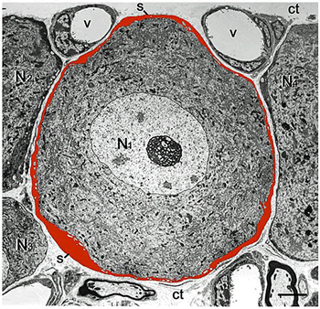 Satellite glial cell (red) surrounding sensory neuron