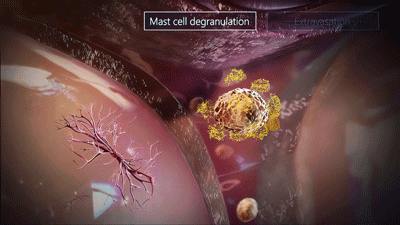 mast cell degranulatio