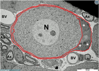 Satellite glial cells