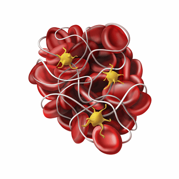 Blood clots