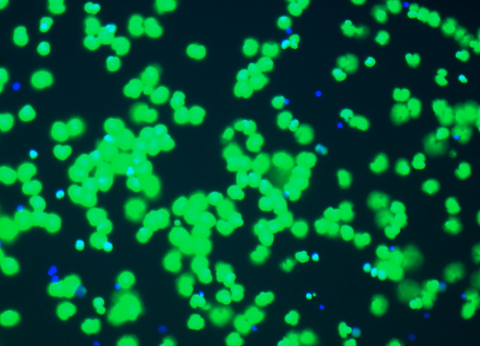 Sticky Nets and Damaged Blood Vessels: A Long COVID Subset is Born?