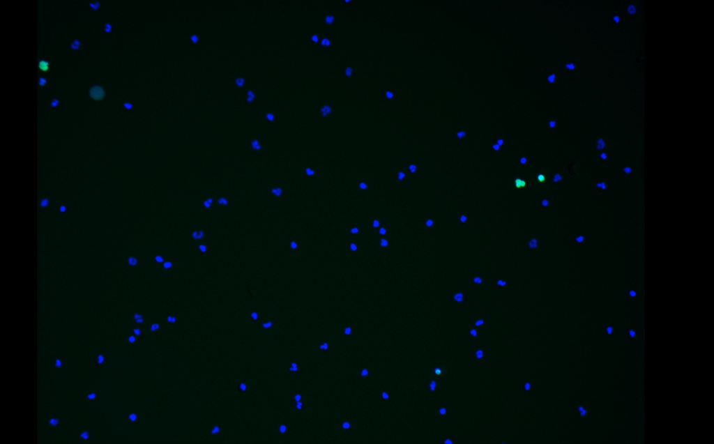 Neutrophils in healthy controls