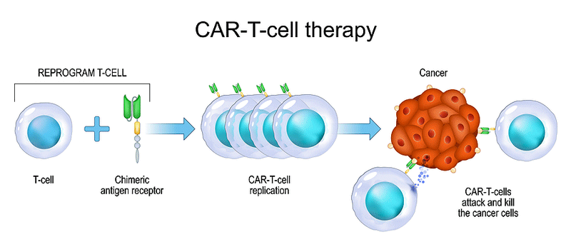 CAR-T-cell therapy