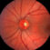 Visible At Last? Are Long COVID and ME/CFS Tissue Diseases? The PolyBio 2026 Symposium Pt ITissue
