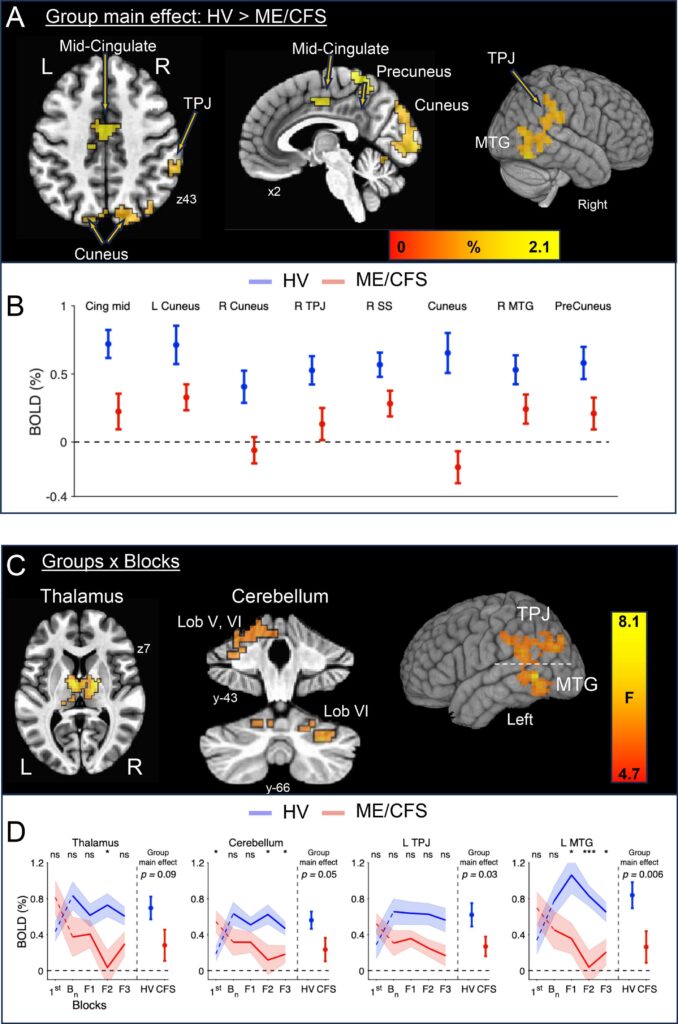 BOLD MRI Readings