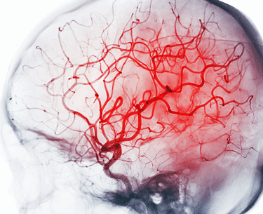 brain blood vessels