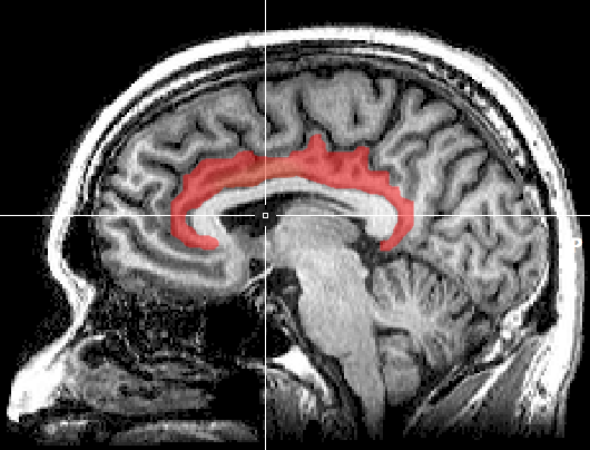 The cingulate cortex