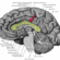 Frayed Brain Connections in ME/CFS Tell a Tale